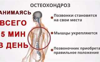 Как лечить шейный остеохондроз