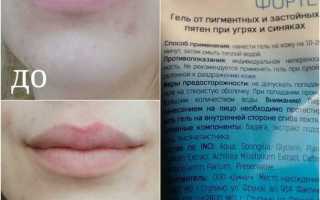 Избавляемся от послеэффектов прыщей на лице