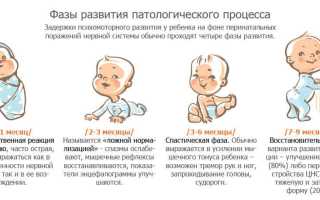 Способы лечения перинатального повреждения нервной системы: все, что вам нужно знать