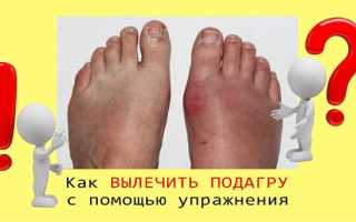 Чем лечить подагру