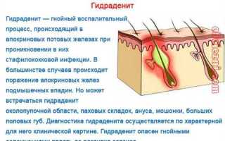 Причины появления прыщей в паховой области