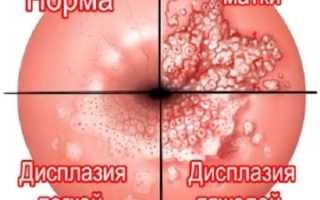 Что такое цитограмма
