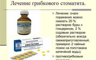 Лечение стоматита во рту