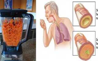 Как избавиться от мокроты в легких