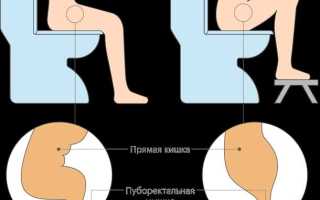 А вы знаете, что такое дефекация?