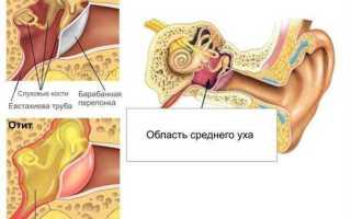 Основные симптомы тубоотита