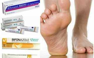 Как избавиться от микоза стопы быстро и надежно