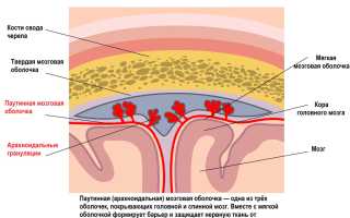 Как лечить арахноидит