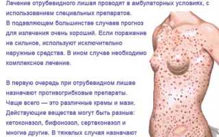 Как лечить розовый лишай