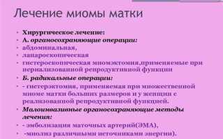 Как лечить миому матки