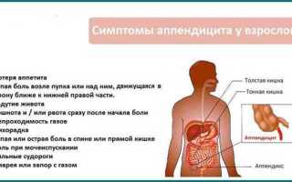 Как определить у ребенка аппендицит по 7 симптомам