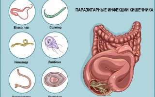Как лечить кишечные колики