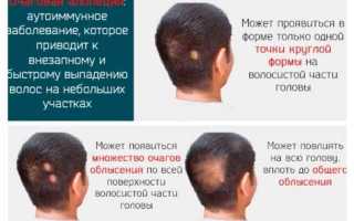 Как избавиться от выпадения волос