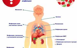 Симптомы при заражении крови