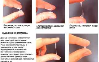 Влагалищные выделения когда норма а когда патология