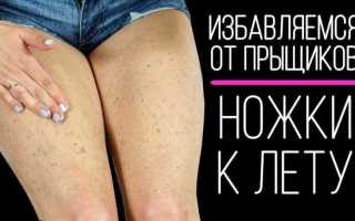 Как избавиться от гусиной кожи