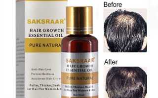 Лечение волос от выпадения