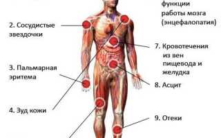 Симптомы и лечение вирусного гепатита B
