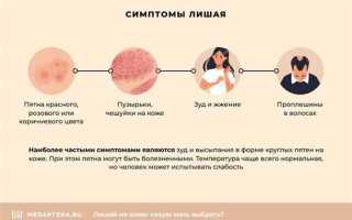 Чем лечить лишай у детей