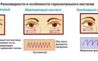 Как лечить нистагм
