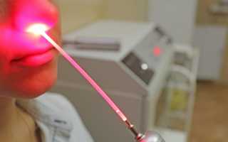 Тубоотит и вазомоторный ринит