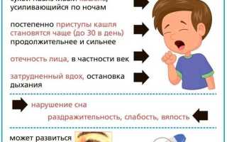 Возможно ли заболеть коклюшем после прививки и почему это может произойти?