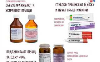 Как избавиться от акне в домашних условиях