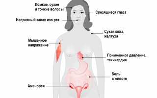 Симптомы анорексии