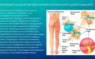 Как лечить корешковый синдром