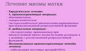 Как избавиться от миомы без хирургического вмешательства