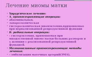 Как избавиться от миомы без хирургического вмешательства