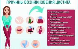 Симптомы цистита у женщин