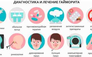 Как лечить гайморит без прокола