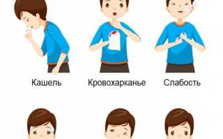 Симптомы туберкулёза лёгких
