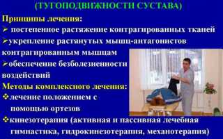 Как лечить контрактуру