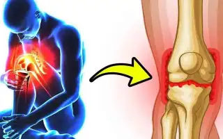 Боли в колене: причины, диагностика, лечение