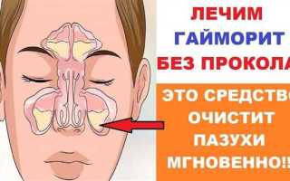 Как лечить гайморит хронический