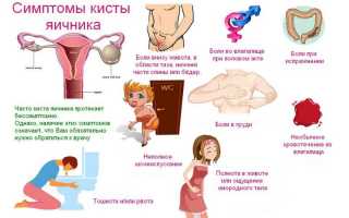 Симптомы кисты требуют внимания и своевременного лечения