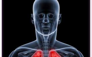 Лечение бронхита