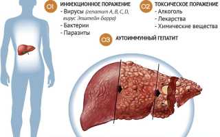 Симптомы заболевания печени