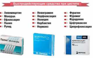 Лечение цистита у женщин: эффективные методы и рекомендации
