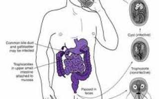 Как избавиться от лямблий