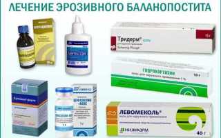 Чем лечить баланопостит