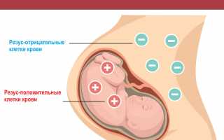 Что такое гемолитическая болезнь новорождённых