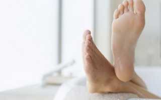 Как избавиться от шпоры на пятке