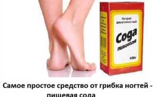 Лечение грибка содой