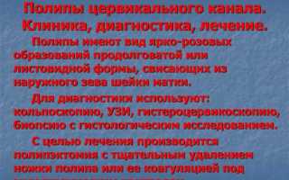 Как лечить полипы шейки матки