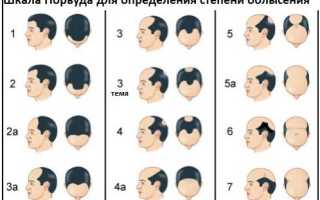 Признаки лечение симптомы облысения