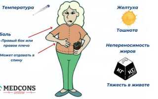 Симптомы холецистита