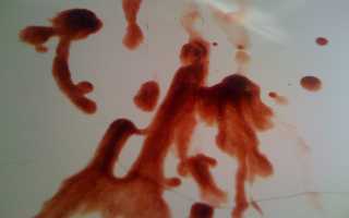 Семяизвержение с кровью